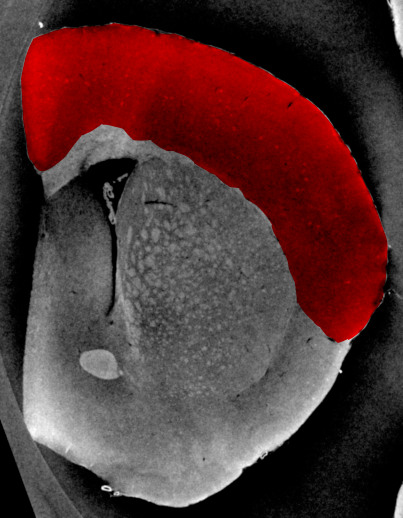 Cortex Image