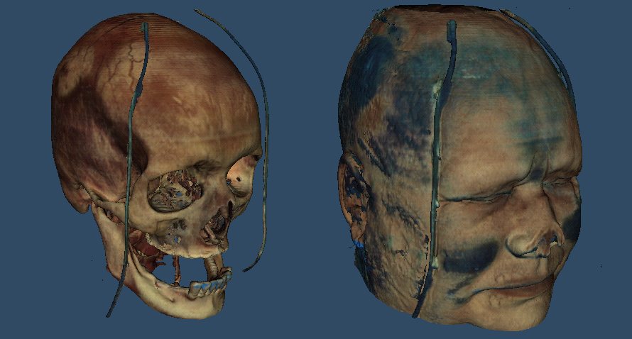 Visible Human Head Rendering